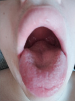 Неиспользованная дырка  – Фото 2